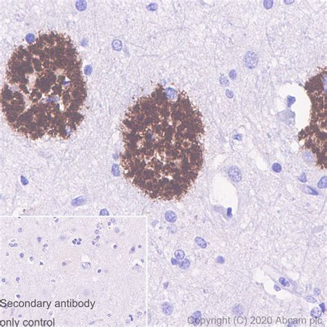 Recombinant Anti Amyloid Precursor Protein Antibody [7c8] Ab273452