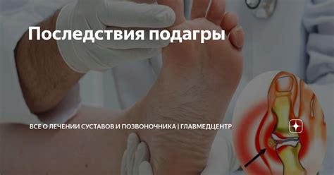 Последствия подагры | Многопрофильная клиника в Санкт-Петербурге ...