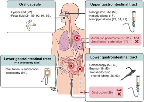 Frontiers Hot Topics On Fecal Microbiota Transplantation For The