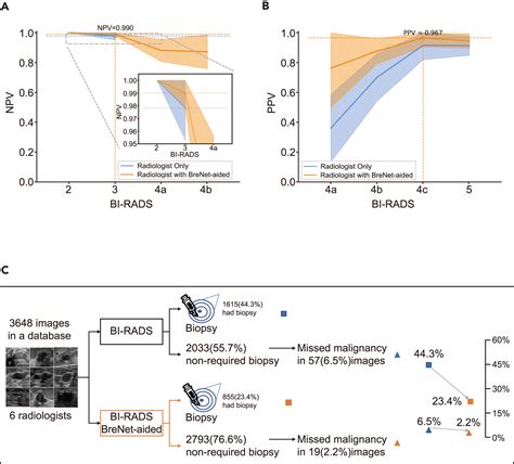 Assessing Breast Disease With Deep Learning Model Using Bimodal Bi View