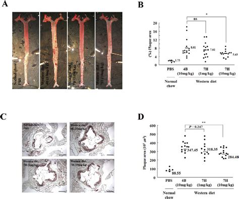 Administration Of 7h Causes A Decrease In Atherosclerotic Plaque