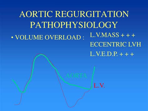 Ppt Aortic Regurgitation Powerpoint Presentation Free Download Id3875684