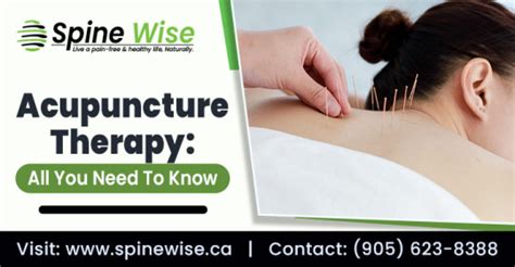 Spinewise — Acupuncture Therapy All You Need To Know