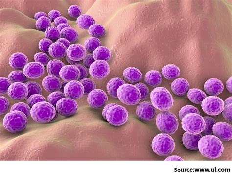 Antibiotic Combinations Reduce Staphylococcus Aureus Clearance Prevent It