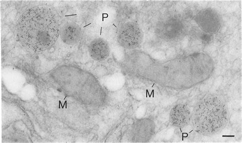 An Electron Micrograph Of An Ultrathin Section Of Normal Rat Liver Download Scientific Diagram