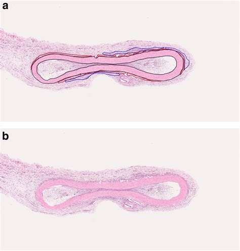 Annotation And Representative Histological Features Of The Thoracic