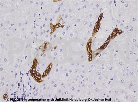 anti-Keratin K19 mouse monoclonal, Ks19.1 (A53-B/A2), lyophilized ...