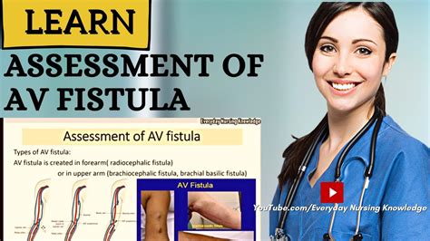 Assessment Of Av Fistula I Everyday Nursing Knowledge Youtube