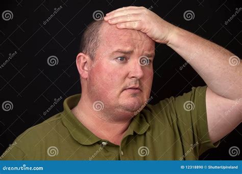 Overweight Male With A Sore Head Pain Stock Photo Image Of Copy Head