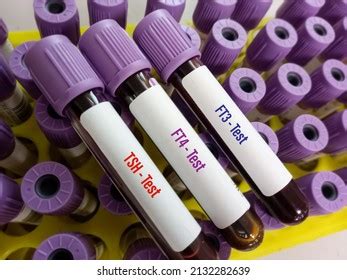 Blood Sample Thyroid Panel Hormone Test Stock Photo 2132282639 | Shutterstock