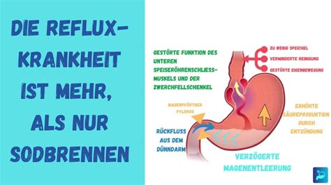 Faktoren Zur Entstehung Der Refluxkrankheit Youtube