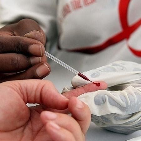 Acesso ao diagnóstico precoce é uma peça chave no enfrentamento do HIV