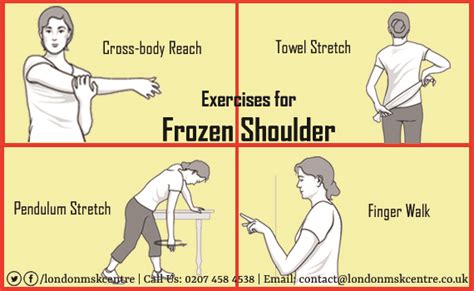 Frozen Shoulder Exercises London Musculoskeletal Centre Orthopedic