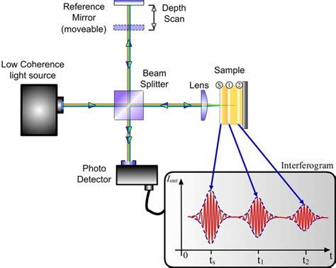 Optical Coherence Tomography