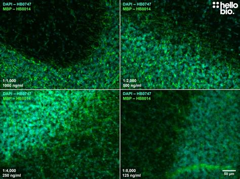 Anti Myelin Basic Protein Mbp Antibody Validab Mbp Oligodendrocyte