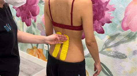 Vendaje Neuromuscular Kinesiotaping Beneficios Y Aplicaciones En