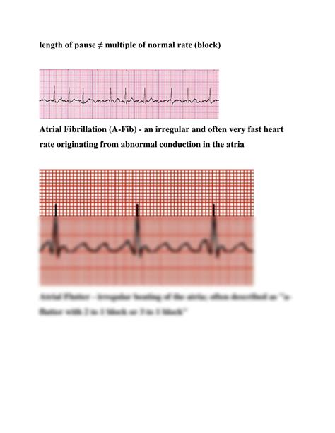 Relias Basic Dysrhythmia Test A Answers Relias Dysrhythmia B