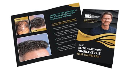 No Shave NS - No-Shave FUE Hair Transplants Atlanta