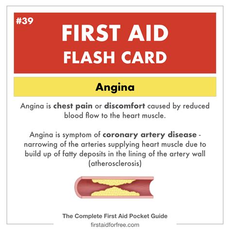 First Aid Flashcard 39 – Angina.001 – First Aid for Free