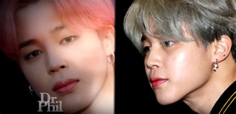 Jimin Surgery Oli Surgeries Jawbone Kpopbuzz