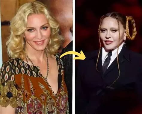 Madonna Plastic Surgery Secrets - Revealed | Fabbon