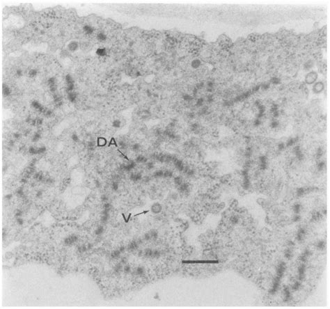 Electron Micrograph Of A Mesophyll Cell From A N Rustica Plant