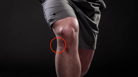 IT Band Syndrome Knee Injury For Athletes Physiovive