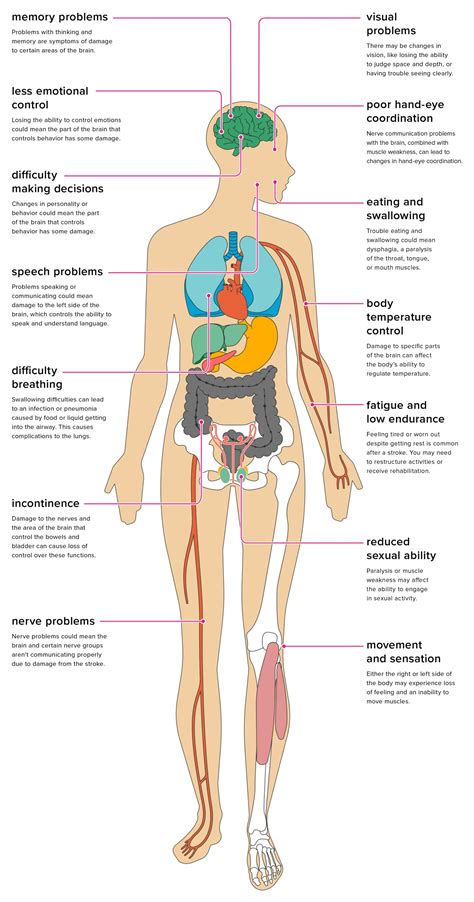 The Effects Of Stroke On The Body Cape Rehab Team Cape Town