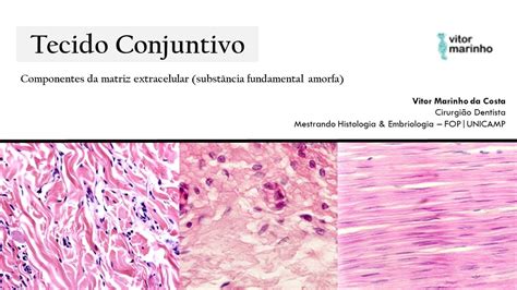 Tejido Conectivo Caracter Sticas Matriz Extracelular Matriz Amorfa