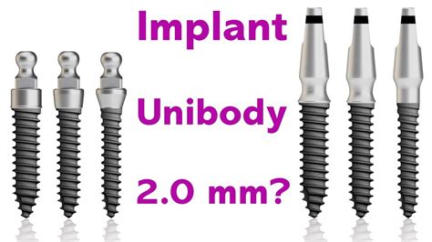 Implant Osstem Ms Youtube