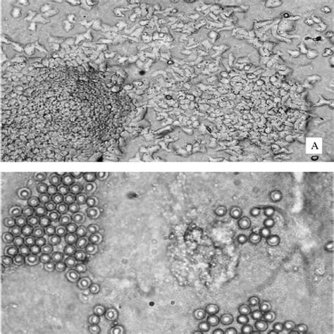 Photomicrograph Of Acanthamoeba Trophozoites And Cysts With 320× A Download Scientific