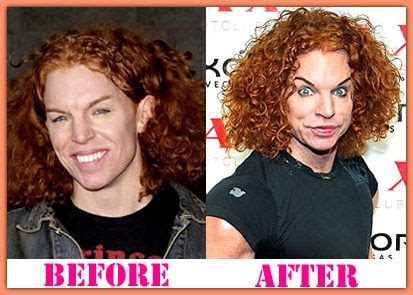 CARROT TOP BEFORE AND AFTER