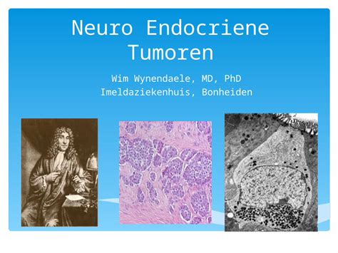 Ppt Neuro Endocriene Tumoren Wim Wynendaele Md Phd Imeldaziekenhuis