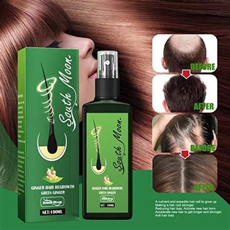 Growthplus Nourishing Ginger Sprayhair Growth Serum Spray Hair Lotionregrowth Nourishing