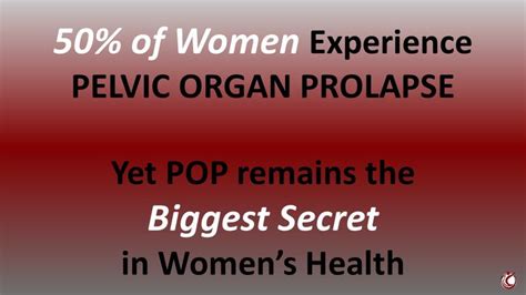 Must Read For 50 Of Women Pelvic Organ Prolapse Womens