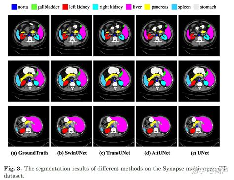 Swin Unet Unet like Pure Transformer for Medical Image Segmentation 知乎