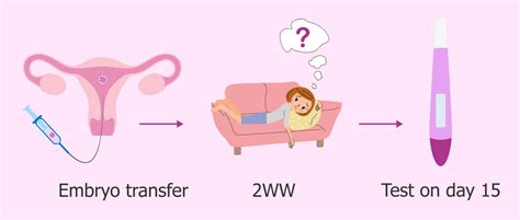 Myths And Facts Of Embryo Transfer Ziva Fertility