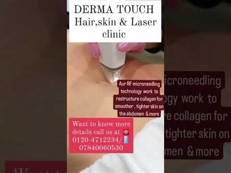 Dermatouchclinicnoida Dermatouch Mnrf Skincare Bodypositivity