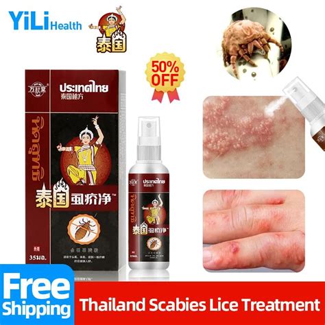 Pubic Lice Treatment Medicine Spray Scabies Remover For Men Mites