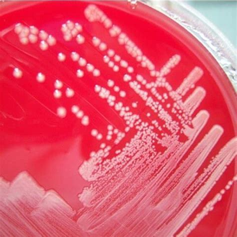 Microbiology On Instagram Acinetobacter Baumannii Agar Sangre