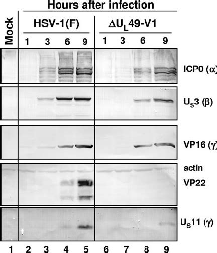 Vhs Accumulation And Shutoff Of Protein Synthesis In Vero Cells