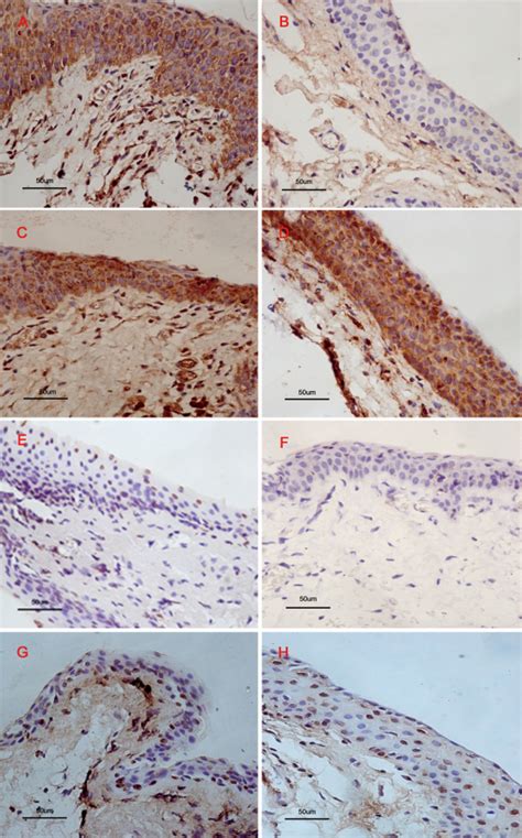 Immunohistochemical Staining For Bcl 2 Bax Mutant P53 And TUNEL