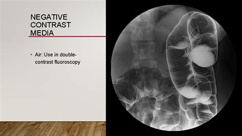 Contrast Media In Radiology Suppat Ittimakin Md Contrast