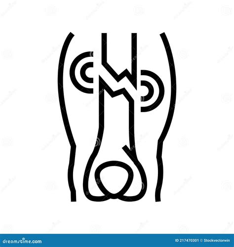 Closed Limb Fracture Disease Line Icon Vector Illustration Stock Vector