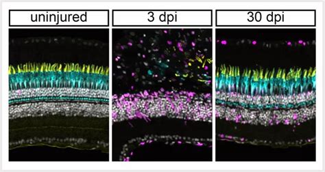 restoring  retina   regenerate photoreceptors  inherited