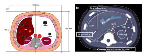 A Scheme Adapted From The Data Sheet Of The Abdominal CIRS Phantom A