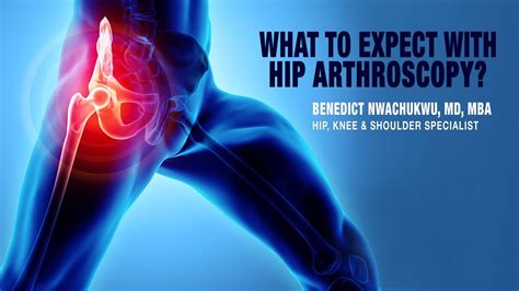 What To Expect With Hip Arthroscopy Hip Pain Therapy Physical