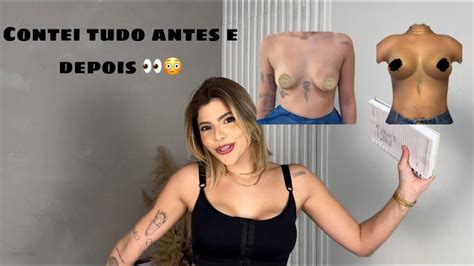 Tudo Sobre Meu Silicone Falei Valores Youtube