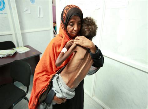 Yemen Facing The World S Worst Famine In 100 Years If Fighting Does Not Stop Warns The Un