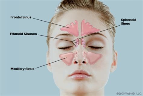 Sinus Eye Symptoms